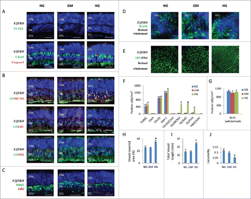 Figure 4. E2f1 knockout rescued high glucose-induced cell death, but had no effects on high glucose-induced ectopic cell division and hyperoxia-induced regression of retinal vascular vessels. (A) Sections from P8 E2f1−/− mouse retinal explants cultured for 7 days under indicated conditions were stained for nuclei (DAPI, blue), cell death (TUNEL, green), apoptosis (active caspase 3, red) and bipolar cells (Chx10, green). (B) Sections from P8 E2f1−/− mouse retinal explants cultured for 7 days under indicated conditions, and were labeled with 100 μM EdU for 1 hour before fixation, were stained for nuclei (DAPI, blue), Müller glia cells (GS, green), all cell cycle phases (MCM3, red), S phase of cell cycle (EdU, red) and M phase of cell cycle (PH3, red). (C) Sections from P8 E2f1−/− mouse retinal explants cultured for 7 days under indicated conditions, and were labeled with 100 μM EdU for 1 hour before fixation, were stained for nuclei (DAPI, blue), bipolar/ganglion/cholinergic amacrine cells (Isl-1, green) and S phase of cell cycle (EdU, red). (D) Wholemont retinas from P8 E2f1−/− mouse retinal explants cultured for 7 days under indicated conditions, a were stained for nuclei (DAPI, blue) and ganglion cells (Brn3, green). (E) Wholemont retinas from P8 E2f1−/− mouse retinal explants cultured for 7 days under indicated conditions were stained for vascular endothelial cells (IB4, green). (F) Quantification of TUNEL+ cells, active caspase 3 (cas3)+ cells, Chx10+ bipolar cells, Isl-1+ bipolar /ganglion/cholinergic amacrine cells, Chx10+/cas3+ dying bipolar cells, ectopic dividing Müller glia cells (including MCM3+/GS+ cells, EdU+/GS+ cells and PH3+/GS+ cells) and ectopic dividing bipolar cells (Isl-1+/EdU+ cells) per mm2 E2f1−/− retinal section areas. (G) Quantification of Brn3+ ganglion cells per mm2 of wholemont of E2f1−/− retinal explants. (H–J) Quantification of vessel coverage (H), total vessel length (I), and lacunarity (J) of E2f1−/− retinal explant by AngioTool software. Error bars represent SD of measurements from at least three animals and asterisks indicate significant differences between retinas of NG group and the indicated groups (*, p < 0.05, t test). Scale bar = 50 μm. ONL: outer nuclear layer; INL: inner nuclear layer; GCL: ganglion cell layer.