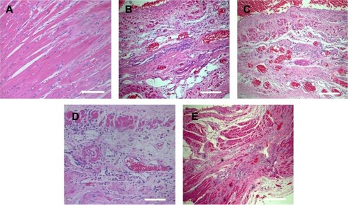 Figure 4 Histology evaluation of an ischemic heart.Notes: (A–E) H&E staining of the tissue sections obtained from the MI region among the (A) sham group, (B) control group, (C) IGF-1 release group, (D) BIO release group, and (E) BIO and IGF-1 co-delivery group. Scale bar, 100 µm.Abbreviations: BIO, 6-bromoindirubin-3-oxime; IGF-1, insulin-like growth factor 1; H&E, hematoxylin and eosin; MI, myocardial infarction.