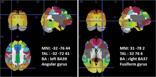 Figure 2. T0 vs. T1 EMDR PSD difference localization analysis.