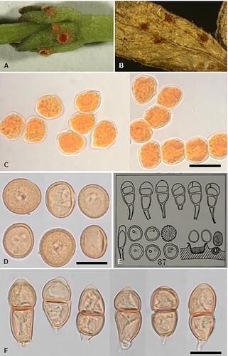 Figure 6. Puccinia austropunctata on Galium spp.: A, Aecia. B, Uredinia. C, Aeciospores. D, Urediniospores. E, Figure 87, reproduced from Cunningham (Citation1931). F, Teliospores. Scale bars = 20 μm.