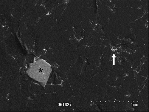 Figure 3. Scanning electron micrograph of the retrieved polyethylene liner showing a sharp-edged alumina particle (asterisk) and irregular-shaped metal particle (arrow) embedded in the polyethylene. The elements contained in the material were identified using energy-dispersive radiographic analysis.