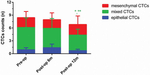 Figure 4. Dynamic changes of three CTCs types in the metastasis-free group. (Data were presented as mean ± SD and P < 0.05 was considered statistically significant. Pre-op: preoperatively, post-op 6m: 6 months postoperatively, post-op 12m: 12 months postoperatively. * P < 0.05 Post-op 12m vs. Pre-op; ** P < 0.05 Post-op 12m vs. Post-op 6m.).