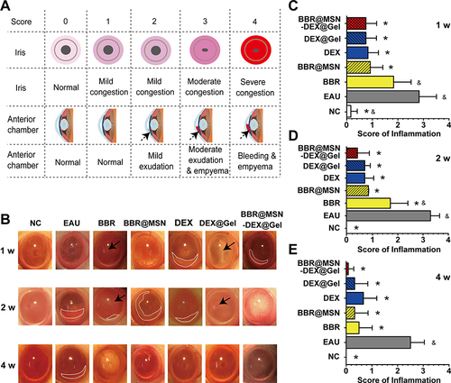 Figure 4 Treatment effectiveness of BBR@MSN-DEX@Gel on IRBP-induced EAU eyes. (A) Grading system of uveitis: schematic representation of inflammation manifestation, evaluation indicators, and score sheet. (B) Representative photographs of external ocular appearance of NC, EAU, and all treated eyes. (C) The mean clinical score of inflammation manifestation of IRBP-induced EAU eyes with or without treatments by BBR solution (BBR), BBR@MSN, DEX solution (DEX), DEX@Gel and BBR@MSN-DEX@Gel (n = 6). *p<0.05 vs EAU and &p<0.05 vs BBR@MSN-DEX@Gel (Two-way ANOVA).