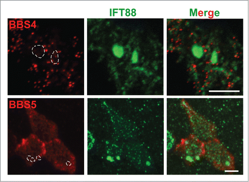 Figure 6. BBSome proteins are normally distributed and do not accumulate at the distal tips in Cby−/− ciliated cells. ALId21 Cby−/− MTECs were immunostained for IFT88 (green) and either BBS4 or BBS5 (red), as indicated. BBS4 and BBS5 did not accumulate in the areas positive for IFT88 aggregations (dashed enclosures). Scale bars: 5 µm.