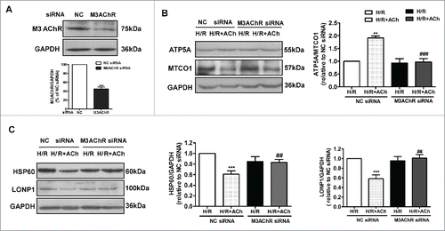 Figure 6. Knockdown of M3AChR blocked the beneficial effects of ACh during H/R. (A) Silencing efficiency of M3AChR siRNA. Cells were transfected with siRNA followed by H/R. (B) ACh administration restored the mitonuclear protein balance, and M3AChR siRNA abolished the protective effects. Changes in HSP60 and LONP1 expression (C) were determined after application of M3AChR/NC siRNA with or without ACh. The data expressed as mean ± SEM in each bar graph represent the average of 4 independent experiments. **P < 0.01 vs. NC siRNA group; ***P < 0.001 vs. NC siRNA group; ##P < 0.01 vs. ACh-treated NC siRNA group; ###P < 0.001 vs. ACh-treated NC siRNA group.