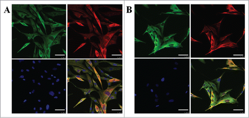 Figure 5. The expression of CK19, CK14, CK7 and CEA in fibroblasts after transfection. Immunofluorescent images of fibroblast cells transfected with pcDNA3.1(+)-NF-κB and pcDNA3.1(+)-Lef-1. Single color and merged images for CEA (green), (red) and nucleus (blue) staining are shown in A. Single color and merged images for CK14 (red), CK19 (green) and nucleus (blue) staining are shown in B. The scale bar represents 50 μm (top row). Representative photomicrographs are shown for three independent experiments. Red and green could not be seen in the control group.