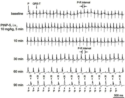 Figure 6 Representative ECGs showing the effects of intravenous PtNP-5 (10 mg/kg) on the heart rate and rhythm of a mouse in vivo. PtNP-5 at this dose successively decreased the heart rate, prolonged the P-R intervals (degree I AVB) and induced complete atrio-ventricular conduction block (AVB) (degree III AVB) within the observed 90 mins. PtNP-5 did not induce ventricular tachyarrhythmias or cardiac asystole within 90 mins.Abbreviations: ECG, electrocardiogram; P, P wave; QRS-T, QRS complex and T wave; F, fusion of P wave with QRS complex; R, R wave.