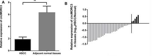 Figure 1 (A) CircMORC3 was downregulated in HSCC tissues compared to paired adjacent normal tissues (n = 33, **P < 0.001). (B) CircMORC3 was downregulated in 84.8% (28/33) of HSCC patients compared to corresponding noncancerous tissues.