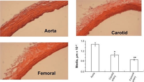 Figure 2B Hematoxylin and eosin staining of different arteries. H and E staining of different arteries was done to determine the structural differences between the arteries. The aorta showed the highest medial thickness and the femoral artery showed lowest medial thickness when compared with the other two arteries. The bar graphs represent the differential medial thickness of the arteries.