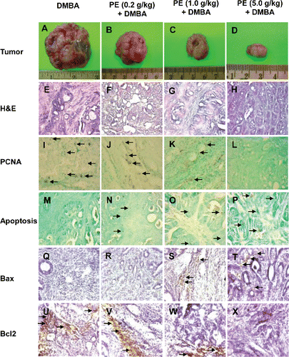 Figure 2. Chemoprevention of 7,12-dimethylbenz(a)anthracene (DMBA)-initiated rat mammary tumorigenesis by pomegranate. Effects of pomegranate emulsion (PE) on the size of mammary tumors (A–D), intratumor histopathological profiles (E–H), cell proliferation (I–L), apoptosis (M–P), Bax (Q–T), and Bcl2 (U–X) protein expression. The rats were treated with oral PE 2 wk prior to and 16 wk following DMBA administration. All animals were sacrificed 16 wk following DMBA exposure. The mammary tumors were subjected to morphological observation as well histopathological (H&E) and immunohistochemical analysis using anti-PCNA, anti-Bax, and anti-Bcl2 antibodies. Apoptosis was detected by DNA fragmentation assay. Magnification: 100× for tumor and H&E and 200× for PCNA, apoptosis, Bax, and Bcl2.