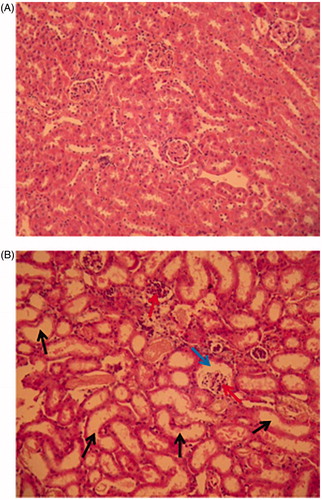 Figure 6. Histological analysis of kidneys of female mice after single IP injection of 750 mg rhCypA/kg. Representative kidney section from control and treatment group are shown. Tissue sections were stained by hematoxylin-eosin; 200× magnification. (A) Control mice. Epithelium of renal tubules, collecting tubules, and glomeruli are not changed. Lumina of collecting tubules are clear and not dilated. (B) Mice IP-treated with 750 mg rhCypA/kg. Renal tubules and collecting tubules are dilated (black arrows), glomerular cavities are expanded (blue arrows), capillary loops are partially destroyed (red arrows).