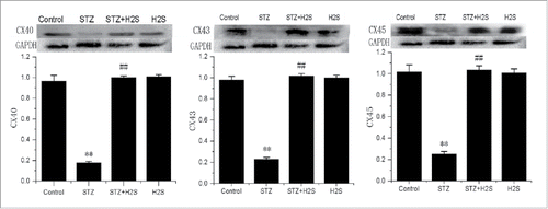 Figure 4. Expressions of CX40, CX43 and CX45 in diabetes rats in each group (normalized by GAPDH; **P < 0.01 vs Control group, ##P < 0.01 vs STZ group).