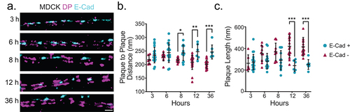 Figure 4. Desmosome architectural changes correspond to E-cadherin exclusion in individual junctions. (a) Representative two-color dSTORM images of desmosomes in MDCK cells over time (magenta: desmoplakin rod/C-terminal junction and cyan: E-cadherin). Quantification of the desmoplakin plaque-to-plaque distance (b) and plaque length (c) according to whether E-cadherin was present (cyan) or not (magenta). (3 h n = 25, 6 h n = 25, 8 h n = 25, 12 h n = 25, and 36 h n = 25) Scale bar = 0.5 μm. * P ≤ .05, ** P ≤ .01, and *** P ≤ .001 by ANOVA with post hoc Tukey’s test.