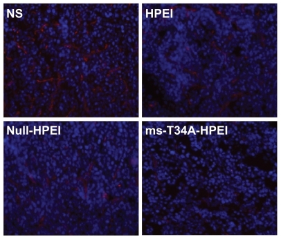 Figure 5 Angiogenesis of tumor tissues stained by CD31 in different groups. It revealed that ms-T34A-HPEI treatment led to a dramatic inhibition of angiogenesis in tumor tissue.Abbreviations: HPEI, heparin-polyethyleneimine; ms-T34A, mouse survivin-T34A; NS, normal saline.