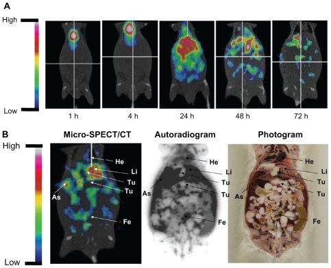 Figure 2 (A) The micro single-photon emission computed tomography (micro-SPECT/CT) of 188Re-liposome-treated C26 peritoneal metastatic tumor-bearing mice. The 188Re-liposomes, containing 12.95 MBq of 188Re, were administered to each mouse by intravenous injection. Micro-SPECT images were acquired at 1, 4, 24, 48, and 72 hours after injection. (B) The whole-body autoradiography image was followed by micro-SPECT image acquisition at 72 hours after 188Re-liposome injection, with the animal in the same position. Tumor nodules are indicated by arrows.Abbreviations: Li, liver; As, ascites; He, heart; Fe, feces; Te, testis; Bl, bladder.