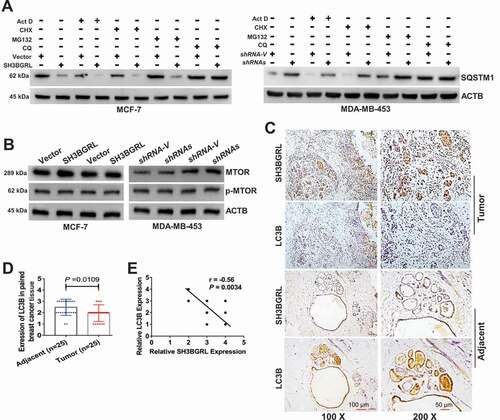 Figure 4. SH3BGRL renders autophagy of breast cancers. (A) Immunoblots of SQSTM1 protein in the MCF-7 cells with SH3BGRL overexpression or MDA-MB-453 cells with SH3BGRL knockdown, respectively. Cells were treated with or without 0.5 µg/ml actinomycin D (Act D), 50 μg/ml cycloheximide (CHX), 20 μM MG132, or 50 μM CQ for 12 h, respectively. (B) Immunoblots of MTOR and its phosphorylated form in the indicated cells. (C,D). Representative IHC staining of total LC3B protein expression in 25 paired human breast cancer tissues compared with adjacent normal ones (C) Scale bars: 100 mm (insets, 50 mm). Statistical LC3B expression is shown (D), P = 0.0109. (E) Correlation analysis of SH3BGRL expression level with that of LC3B in breast cancer tissues. (n = 25; r = −0.56; P = 0.0034).