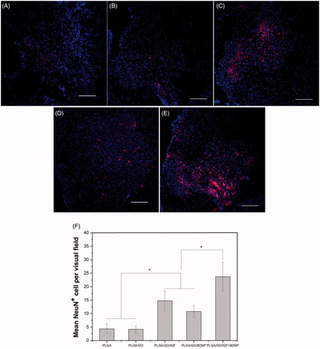 Figure 11. Qualitative and quantitative evaluation of neurons in the injury site after SCI. Immunocytochemical staining of neurons on pure PLGA nanofibers (A), PLGA/GO nanofibers (B), PLGA/GO/IGF nanofibers (C), PLGA/GO/BDNF nanofibers (D) and PLGA/GO/IGF + BDNF nanofibers (E). Immunostaining makers are NeuN for neurons and DAPI for nuclei. The Scale bar was 100 µm. (F) Mean NeuN positive cells per visual field. (∗, p < .05, n = 3).