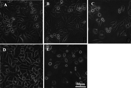 Figure 1. Morphology of HepG-2 cells with or without lycorine treatment in vitro. Inverted microscopy (magnification 10 × 40). Cells treated with lycorine 3 μmol/L (A), 6 μmol/L (B) or 12 μmol/L (C); Control (D); Cells treated with 4 μmol/L HCPT (E).