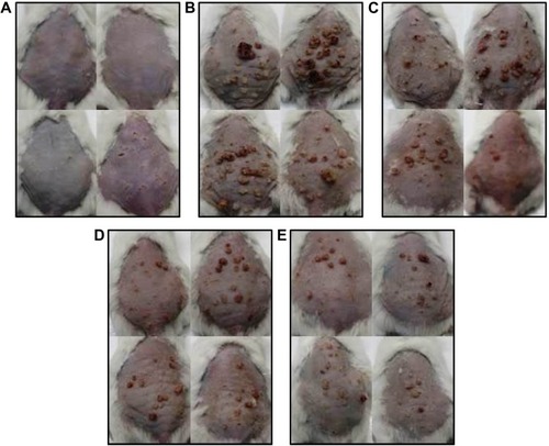 Figure 1 Effect of Leiurus quinquestriatus venom extract on DMBA/croton oil-induced mouse skin tumorigenesis.