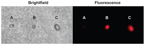 Figure 9 Bright-field and fluorescent images of the sentinel lymph nodes resected from mice that were not injected with liposome-coated chlorophyll or chlorophyll alone (A), injected with liposome-coated chlorophyll (B), and chlorophyll alone (C).