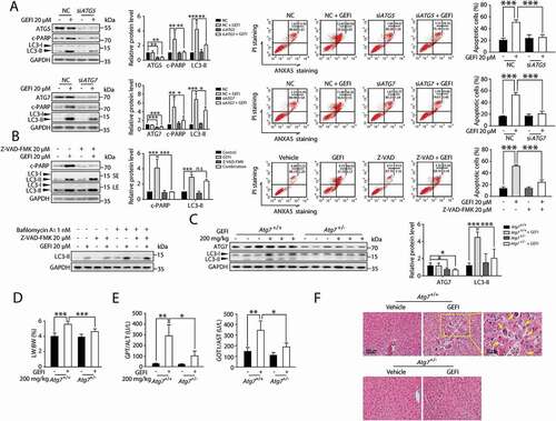 Figure 3. Gefitinib-induced autophagy promotes apoptosis-associated hepatotoxicity. (A) HL-7702 cells were transfected with siRNA, targeting ATG5 (siATG5) or ATG7 (siATG7), or non-targeting siRNA (NC) for 24 h as indicated, followed by treatment with or without gefitinib. Relative protein expressions were detected by western blot. Apoptotic cells were identified using ANXA5-PI staining by flow cytometry after 48-h exposure (n = 3, one-way ANOVA, LSD test). (B) Determining the effect of Z-VAD-FMK on HL-7702 cells treated with gefitinib. Relative protein expressions were detected by western blot. Apoptotic cells were identified by flow cytometry after 48-h exposure (n = 3, one-way ANOVA, LSD test). (C-F) Atg7+/+ and Atg7+/- mice (n = 6 per group) were treated with gefitinib (200 mg/kg/day) by gavage for 4 weeks. The livers and sera were extracted. (C) The expressions of ATG7 and LC3 were analyzed by western blot. (D) Relative liver weights were calculated (n = 6, one-way ANOVA, LSD test) and (E) the levels of GPT/ALT and GOT1/AST were analyzed (n = 6, one-way ANOVA, Dunnett T3 test). (F) H&E staining of liver tissues. For 100× magnification, scale bar: 100 µm; for 200× magnification, scale bar: 50 µm. Yellow arrowheads indicated the cellular level showing prominent hematoxylin and eosin staining objects that were suggestive of apoptosis in specific regions. Western blot was repeated at least three times and densitometric analysis was carried out. The results are presented as the mean ± SD. n.s = no significance; *p < 0.05; **p < 0.01; ***p < 0.001. Abbreviations: GEFI, gefitinib; c-PARP, cleaved PARP; LW, liver weight; BW, body weight; GOT1/AST, glutamic-oxaloacetic transaminase 1, soluble; GPT/ALT, glutamic pyruvic transaminase, soluble; H&E, hematoxylin and eosin; SE, short exposure; LE, long exposure