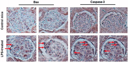 Figure 3. Increased Bax and Caspase-3 expression in the kidney of septic AKI mice. Bax (left) and Caspase-3 (right) expression was assessed by the IHC analysis and visualized under light microscope. Increased Bax and Caspase-3 expression in the kidney of septic mice (arrow heads).Data shown here are at least one out of three independent experiments.