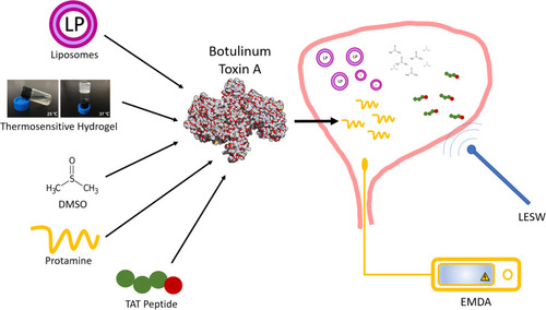 Figure 1 Different approaches for intravesical delivery of botulinum toxin.