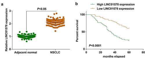 Figure 1. Prognostic role of LINC01578 in LC. (a). LINC01578 expression in NSCLC tissues; (b). Effect of LINC01578 expression on prognosis of patients. Measurement data were presented as mean ± standard deviation.
