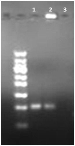 Figure 2. Confirmation of liposome–aptamer conjugation. Samples are loaded onto the agarose gel. After running time, the gel was visualized by UV light. Lane 1: free 5TR1 aptamer; 2: 5TR1-liposomes; 3: liposome without conjugation.