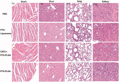 Figure 7. H&E staining images of major organs after treatment (heart, liver, lung, kidney. 40×, the scale bar represents 50 µm).