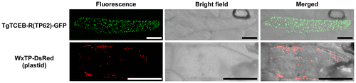 Fig. 5. Subcellular localization of TgTCEB-R.