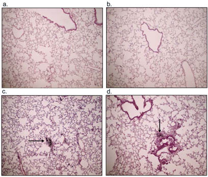 3 Representative examples of H&E staining of (a) saline, (b) acid-washed PM 1648, (c) PM 1648, and (d) PM2.5 exposed NZM mice 17 weeks following exposure. The PM 1648 and PM2.5 exposed NZM mice showed increases in inflammatory cell infiltration. Saline and AW PM1648 had minimal levels of inflammation. The arrows indicate PM within the lungs 17 weeks following instillation.