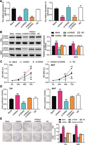 Figure 8 GINS2 silence inhibited cell viability and cell proliferation in bladder cancer cells which was regulated by miR-22-3p. (A) The transfection efficiency of miR-22-3p inhibitor and GINS2 siRNA in the two cell lines. (B) The expression of GINS2 protein was detected by Western blot in BLCA cells after transfecting with miR-22-3p inhibitor, si-GINS2, negative control, blank control and co-transfected miR-22-3p inhibitor and si-GINS2. (C) CCK-8 assay was used to observe the cell viability in T24 and 5637 cell lines after transfecting miR-22-3p inhibitor, si-GINS2, negative control, blank control and co-transfected miR-22-3p inhibitor and si-GINS2. (D) BrdU assay was used to observe the cell proliferation in T24 and 5637 cell lines after transfecting miR-22-3p inhibitor, si-GINS2, negative control, blank control and co-transfected miR-22-3p inhibitor and si-GINS2. (E) Colony formation assay was used to observe the number of colonies in T24 and 5637 cells after transfecting miR-22-3p inhibitor, si-GINS2, normal control, blank control and co-transfected miR-22-3p inhibitor and si-GINS2. *P < 0.05, **P < 0.001 compared with blank group, ANOVA.