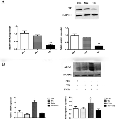 Figure 3. TF knockdown by siRNA blocked FVIIa induced AREG upregulation in LoVo cells. (A) TF expression was significantly downregulated in group TFi at mRNA and protein levels. (B) AREG expression was significantly upregulated in group FVIIa but downregulated in group TFi+ FVIIa. *P＜0.05, **P＜0.01.