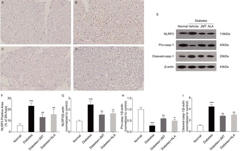 Figure 5 JMT regulated NLRP3 inflammasome expression in SNs of diabetic rats.