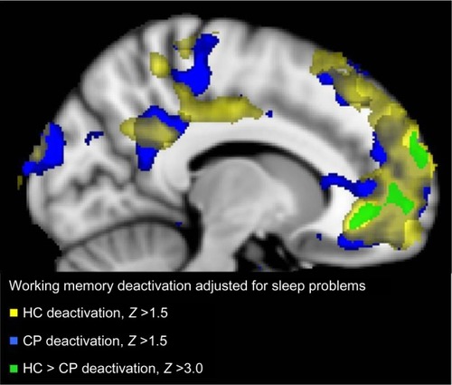 Figure 3 Brain regions with decreased activation at the whole brain level for contrast 0-back > 2-back with sleep problem score (PSQI), and scores for depression (BDI) and pain (NRS) as orthogonalized covariates in the CP group alone (blue), HC group alone (yellow), and the significant difference between them (HC > CP; green).