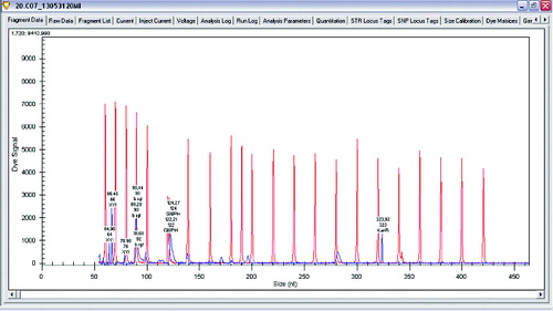 Figure 1. Gene expression levels of xylanase, β-xylosidase and glucose-6-phosphate dehydrogenase in Lactobacillus plantarum.