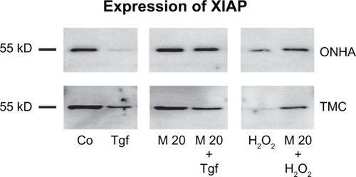 Figure 9 Expression of XIAP. Western blot showing the protein expression of XIAP in control (Co) and treated cell extracts: TGFβ-2 (Tgf), minocycline 20 μM (M20), minocycline 20 μM and TGFβ-2 (M20+Tgf), 600 μM H2O2 (H2O2), and treatment with minocycline 20 μM and 600 μM H2O2 (M20 + H2O2). Ten micrograms of protein were loaded per lane.