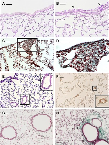Figure 1 Emphysema-associated pulmonary lesions which can be observed in different mouse strains after chronic exposure of CS. Representative histologic sections from lungs of C57 Bl/6J mice at 6 months after air- (A) or CS-exposure (B). Mice practically do not have goblet cells in their bronchi and bronchioles. Note the appearance of clusters of goblet cells in airways after chronic exposure to CS. (C and D) DBA/2 mice at 6 months after CS exposure show evident areas of fibrosis (sea-green stain in the black square) associated with disseminated foci of pulmonary emphysema. This histological picture firstly described in smoking DBA/2 miceCitation25 was subsequently described also in man as “Combined Emphysema –Fibrosis Syndrome” (CPFE)Citation110 In (D), high magnification of the lung parenchyma present in the black square of (C). (E) Histologic section from distal airways from FVBPAR−2-TgN mice showing muscularisation of small (≤80 mm) intrapulmonary vessels that precedes the development of PH (~45% increase) and right ventricular hypertrophy.Citation26 (F) Note in the excessive thickening of a-SMA-positive layers in small intrapulmonary vessels. (in insets: higher magnification of lung parenchyma present in black squares). (G and H) Lung sections from an air-exposed (G) and a CS-exposed (H) C57 Bl/6J mouse at 10 months from the start of the exposure. Distal airways of the air-exposed mice show a normal appearance. Peribronchiolar region from a mouse at 10 months after CS exposure is thickened by an evident fibrotic reaction (sea-green stain) (arrowheads). (A and B): PAS staining; (E): haematoxylin and eosin staining; (C, D, G and H): Masson’s Trichrome staining; (F): Immunostaining with anti-a-SMA antibodies. Scale bars = 40 μm. These images are property of the authors.