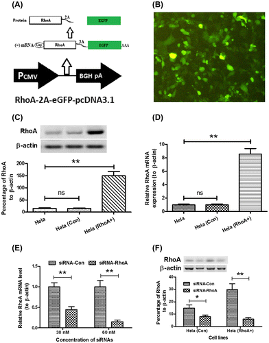 Fig. 3. Construction of a Hela cell line, overexpressing RhoA.Notes: (A) schematic diagram of RhoA and EGFP co-expression with a 2A peptide sequence; the RhoA and EGFP coding sequence linked by 2A peptide coding sequence was cloned into pcDNA3.1 vector; a single mRNA coding CTGF and RFP could translate RhoA and EGFP separately; (B) EGFP expression of Hela (RhoA+) cells; (C) RhoA expression in protein level in the Hela (RhoA+) cells; (D) RhoA expression in mRNA level in the Hela (RhoA+) cells; and (E) and (F) knockdown of RhoA in mRNA level (E) or in protein level (F) by siRNAs. All results are the average of three independent experiments, and statistical significance was considered with a p value < 0.05 or less.