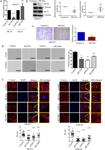 Figure 6. Effects of MCT4 blocking on metastatic features of the ovarian cancer cells.