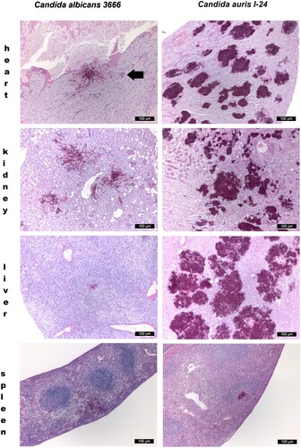 Figure 3. Histopathological examination of the heart, kidney, liver and spleen using Periodic Acid Schiff staining from neutropenic mice intravenously challenged with Candida albicans isolate 3666 (left panels) and C. auris isolate I-24 (right panels), respectively. Histopathological examination was performed six days post infection. In case of C. albicans in the heart, in the kidney and in the spleen blastoconidia and budding yeast cells, pseudohyphae and hyphae were seen. In the liver hyphae were not detected. In the heart both endo- and myocardial involvement is noticeable, the subendocardial myocardium is affected most markedly. Signs of beginning blood vessel invasion in the myocardium is detectable (black arrow). In the kidney C. albicans was detected within the parenchyma, tubuli and glomeruli. In the spleen pseudohyphae and hyphae were seen in the red pulp. C. auris produced large aggregates in the heart, kidney and liver with numerous blastoconidia and budding yeast cells were detected. In the heart coagulative necrosis of myocytes was noticed. In the kidney C. auris cells were detected in the parenchyma, tubuli but not in the glomeruli. In the liver dilated liver sinusoids were filled with yeast cells with central necrosis of lobuli and vacuolar degeneration of hepatocytes. In the spleen yeast cells were seen at the border of the red and white pulp with focal destruction of the white pulp. Small fungal lesions were detectable under the capsule of the spleen and in the sinuses. Magnification × 100.