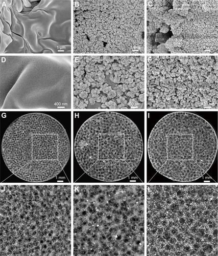 Figure 1 SEM and micro-CT images of porous scaffolds.Notes: SEM images of porous scaffolds: PLLA (A and D), HA/PLLA (B and E), and Sr-HA/PLLA (C and F). Micro-CT images of porous scaffolds: PLLA (G and J), HA/PLLA (H and K), and Sr-HA/PLLA (I and L). Images J, K, and L are ×2.7 magnified images of G, H and I, respectively.Abbreviations: SEM, scanning electron microscope; micro-CT, micro computed tomography; PLLA, poly(l-lactic acid); HA/PLLA, hydroxyapatite on porous poly(l-lactic acid); Sr-HA/PLLA, strontium-doped hydroxyapatite on porous poly(l-lactic acid).