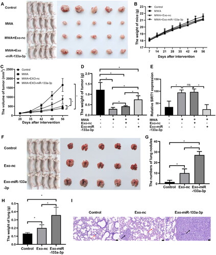 Figure 6. Effect of miR-133a-3p on LC development in vivo. Nude mice were subjected to subcutaneous tumorigenesis model construction followed by MWA. Exosomes derived from miR-133a-3p/miRNA-NC-transfected A549 cells were then transplanted into the caudal vein of mice. (A) Mice in the MWA + Exo-miR-133a-3p group formed larger tumors compared to the MWA + Exo-nc and MWA groups. (B) No significant differences were observed in mouse body weight among the groups. (C) Comparison of tumor volumes. (D) Comparison of tumor weights. (E) Quantitative analysis of immunohistochemical staining for SIRT1 expression in tumors. (F) Nude mice bearing lung tumors were injected with exosomes isolated from A549 cells transfected with pCDH-miR-133-3p and pCDH-miRNA-nc. Lung size in the Exo-miR-133a-3p group was larger than that in the Exo-nc and control groups. (G) Comparison of lung nodules among the different groups. (H) Comparison of lung weights in the different groups. (I) HE staining for changes in histological lesions. Red arrows represent granulocyte infiltration, and black arrows indicate tumor cells with deformed nuclei and blurry nucleoli. Bar = 50 µm, * p <.05.