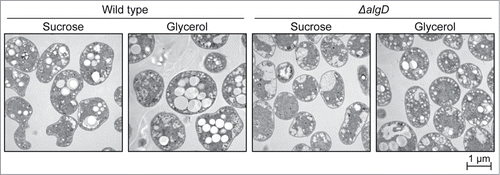 Figure 3. PHB granules in A. vinelandii cells revealed by TEM. Bacteria were cultured for 72 h in S-MB or G-MB as indicated.