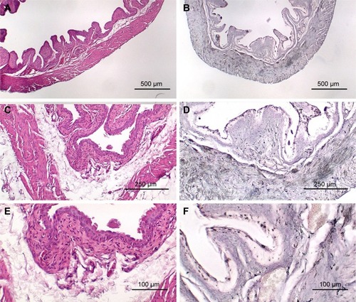 Figure 4 Bladder from age matched mouse that was not treated with BBN but received AuNP injection. (A) H&E, 40×; (B) gold enhanced, 40×; (C) H&E, 100×; (D) gold enhanced, 100×; (E) H&E, 200×; (F) gold enhanced, 200×.Abbreviations: AuNP, gold nanoparticle; H&E, hematoxylin and eosin; BBN, N-butyl-N-(4-hydroxybutyl)nitrosamine.