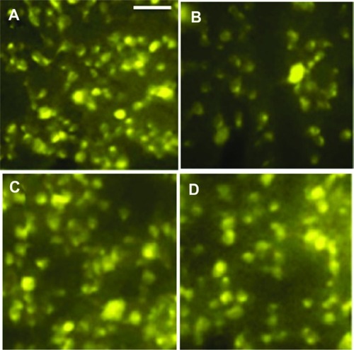 Figure 2 Fluorogold® counting of surviving retinal ganglion cells. (A) Control group, (B) surgery group, (C) low transplant group, and (D) high transplant group.