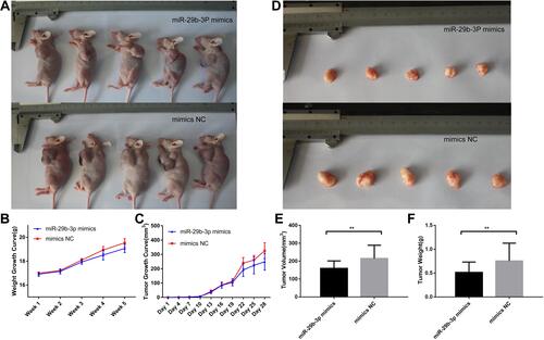 Figure 5 Body characteristics and tumour growth of nude mice injected with transfected AGS cells. (A) Nude mice body shape comparison, (B) Nude mice body weight growth curve, (C) Nude mice tumour growth curve, (D) Nude mice tumour comparison, (E) Nude mice tumour volume after removal. (F) Nude mice tumour weight after removal. **P < 0.01.