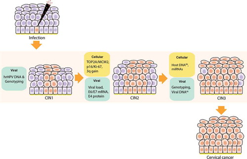 Figure 5. Viral and cellular biomarkers for detecting specific stages of cervical intraepithelial lesions after a hrHPV infection. After hrHPV infection, the cervical epithelia infected starts to proliferate, finally getting transformed to cervical intraepithelial neoplasia (CIN) 1, 2, and 3. Then from CIN3, it progresses to cervical cancer. According to our review, several viral and cellular biomarkers may be useful for detecting different stages of CIN. hrHPV-DNA primary test is the best test so far to apply in population-based screening. Then in CIN1, besides the hrHPV DNA testing we can also use genotyping; for CIN2: TOP2A/MCM2, p16/Ki-67 staining, 3q gain in the chromosome, Viral load, hrHPV transcriptional status (E6/E7 mRNA), and E4 protein, with the latter being able to stratify the heterogenous CIN2 group in safe lesions (E4 positive) and clinically significant lesions (E4 negative); and for CIN3: Host DNA methylation(m), miRNAs, hrHPV genotyping, and Viral DNA methylation (m)