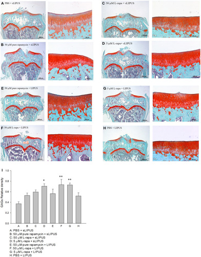 Figure 6 Six-month-old spontaneous OA Dunkin-Hartley guinea pigs were administered with pure rapamycin or L-rapa with LIPUS or sLIPUS for 8 weeks. GAGs in the cartilage of knee stained by safranin O-Fast Green and quantified using Image-Pro Plus 5.1 software. The GAGs in each experimental group were showed at 12.5 and 100 magnificence (A–H). (I) Intra-articular injection of 50 μM and 5 μM L-rapa combined with LIPUS thrice a week, and 5 μM L-rapa with sLIPUS (Groups D, F and G) significantly increased the content of GAGs compared to control (Group A: PBS + sLIPUS). 50 μM and 5 μM L-rapa with LIPUS showed the greatest GAGs-stimulating actions and nearly doubled GAGs density compared to that in control (L-rapa: liposomes-encapsulated rapamycin; LIPUS: low-intensity pulsed ultrasound; sLIPUS: sham LIPUS; *P<0.05; **P<0.01; by one-way ANOVA, Group A: n=5, Groups B~G: n=8, Group H: n=3).